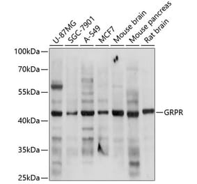 Western Blot - Anti-GRPR Antibody (A14264) - Antibodies.com