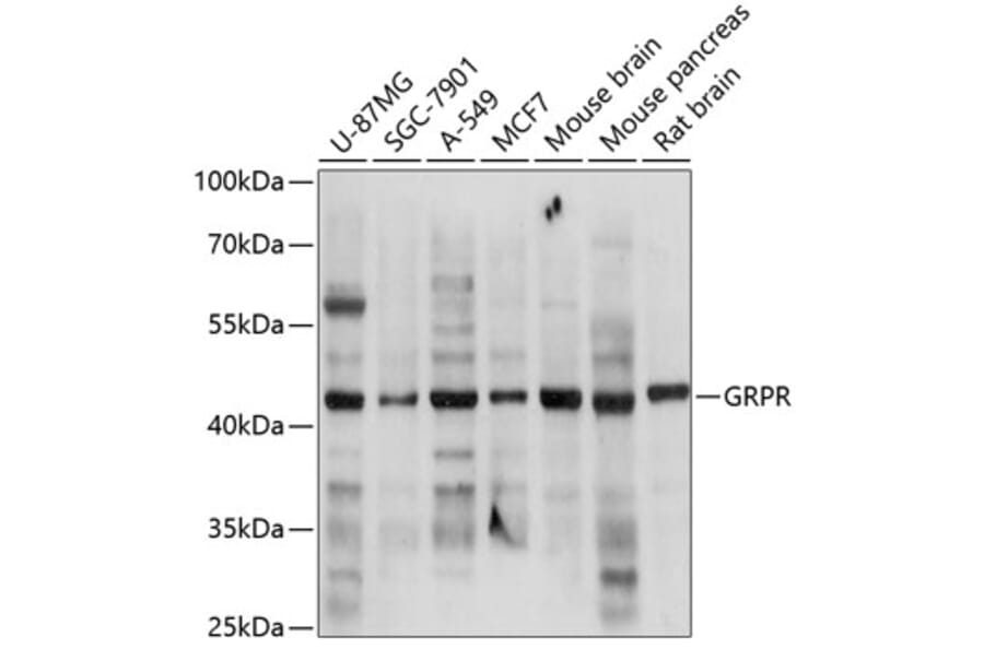 Western Blot - Anti-GRPR Antibody (A14264) - Antibodies.com