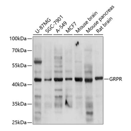 Western Blot - Anti-GRPR Antibody (A14264) - Antibodies.com