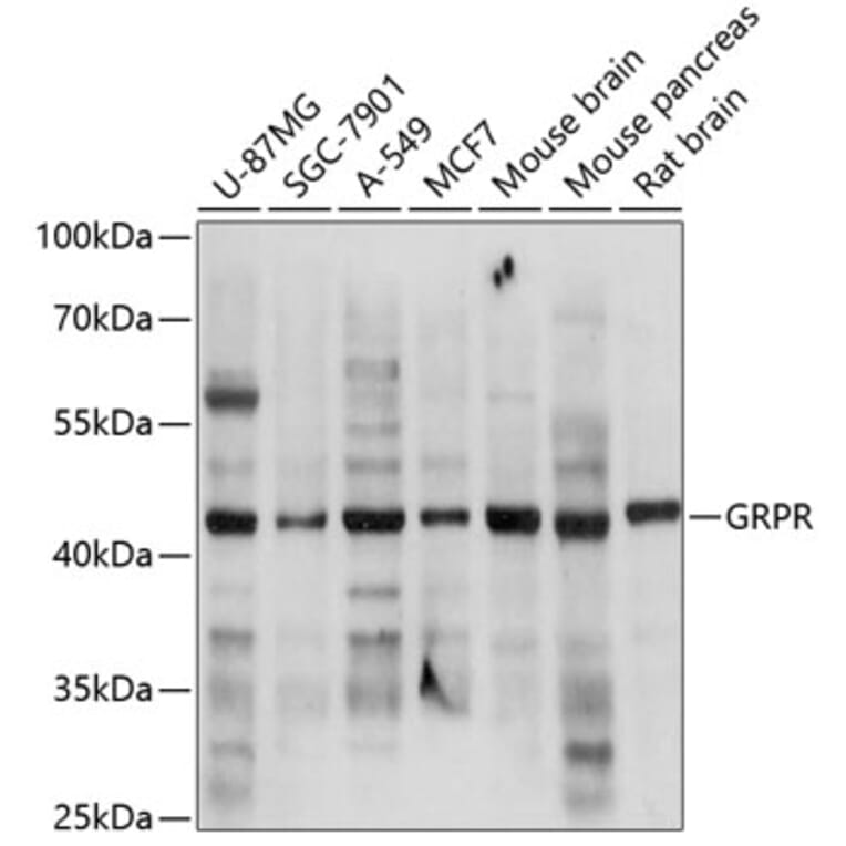 Western Blot - Anti-GRPR Antibody (A14264) - Antibodies.com