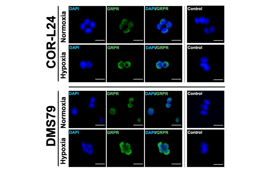 Immunofluorescence - Anti-GRPR Antibody (A14264) - Publication