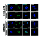 Immunofluorescence - Anti-GRPR Antibody (A14264) - Publication