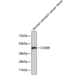 Western Blot - Anti-CCK2-R Antibody (A14265) - Antibodies.com