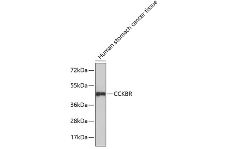 Western Blot - Anti-CCK2-R Antibody (A14265) - Antibodies.com