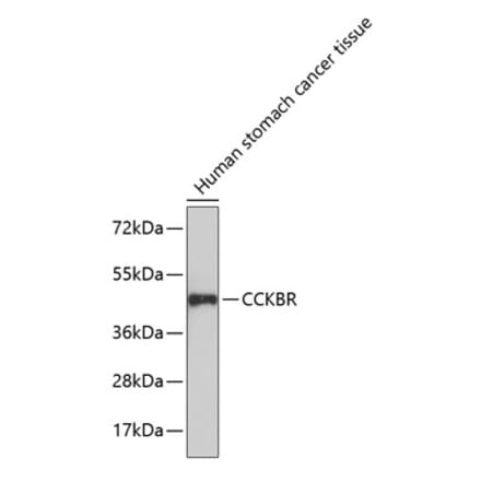 Western Blot - Anti-CCK2-R Antibody (A14265) - Antibodies.com