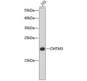 Western Blot - Anti-CMTM3 Antibody (A14267) - Antibodies.com