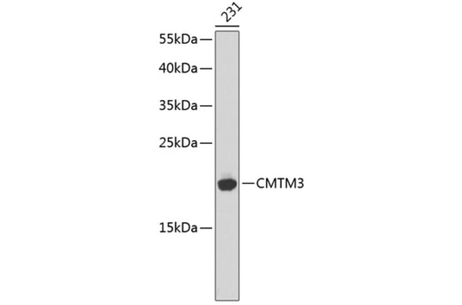 Western Blot - Anti-CMTM3 Antibody (A14267) - Antibodies.com