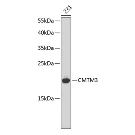 Western Blot - Anti-CMTM3 Antibody (A14267) - Antibodies.com