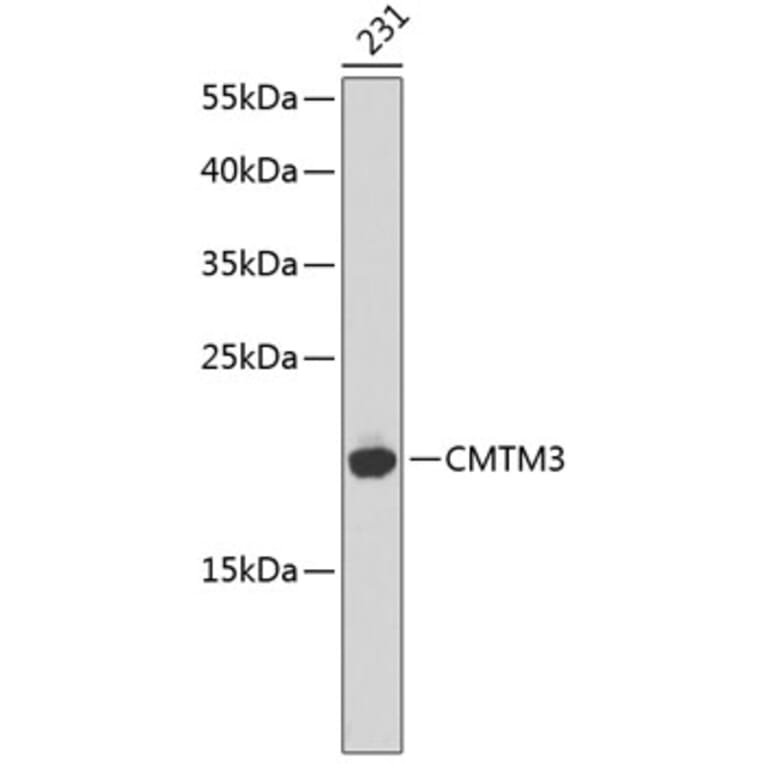 Western Blot - Anti-CMTM3 Antibody (A14267) - Antibodies.com