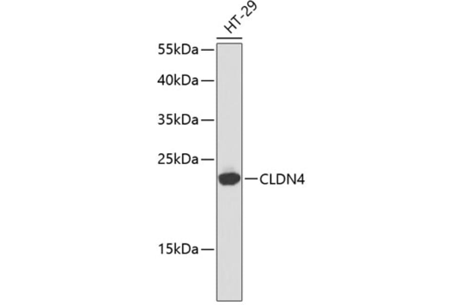 Western Blot - Anti-CLDN4 Antibody (A2947) - Antibodies.com