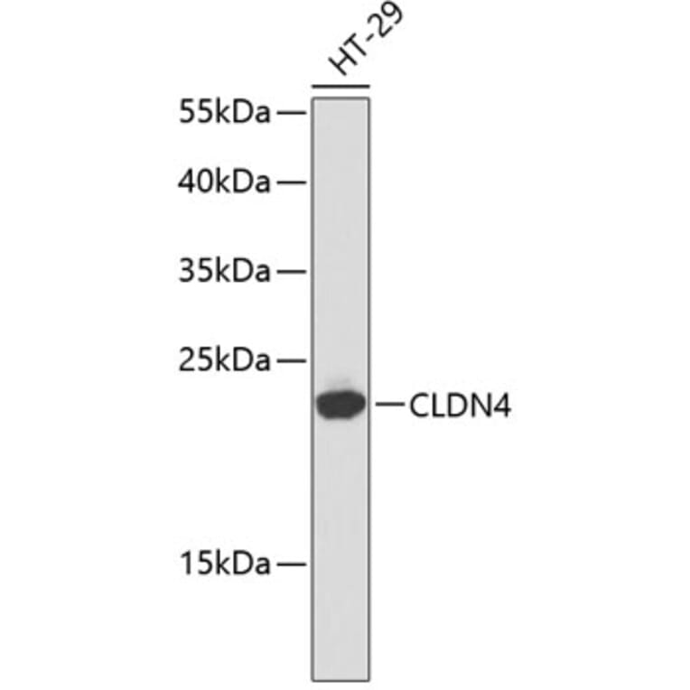 Western Blot - Anti-CLDN4 Antibody (A2947) - Antibodies.com