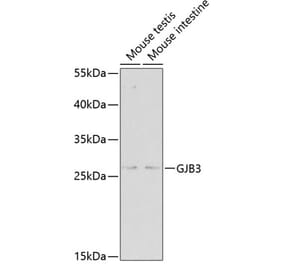 Western Blot - Anti-GJB3 Antibody (A2949) - Antibodies.com