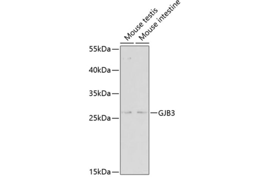 Western Blot - Anti-GJB3 Antibody (A2949) - Antibodies.com