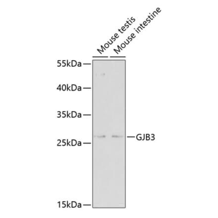 Western Blot - Anti-GJB3 Antibody (A2949) - Antibodies.com