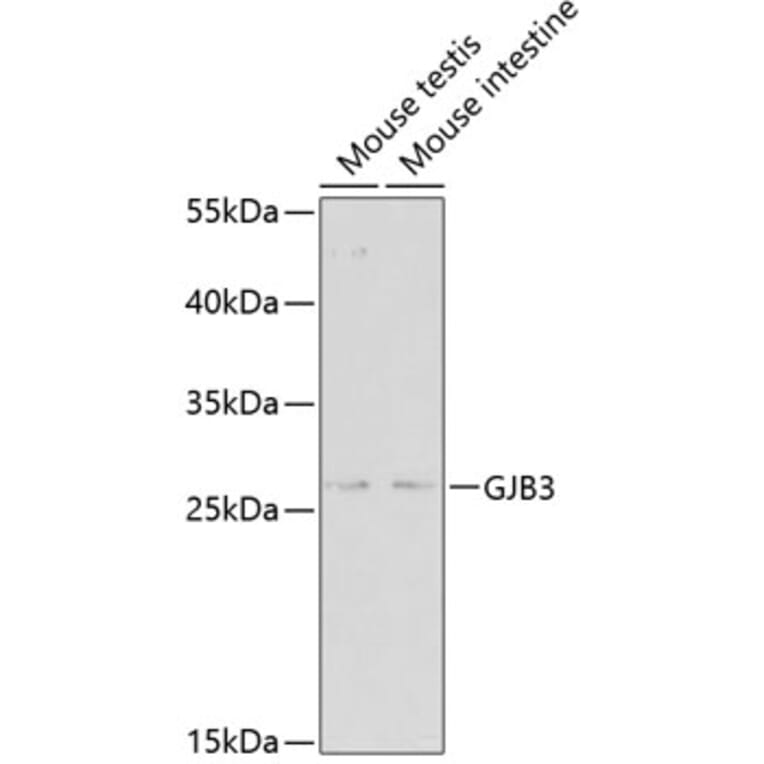 Western Blot - Anti-GJB3 Antibody (A2949) - Antibodies.com