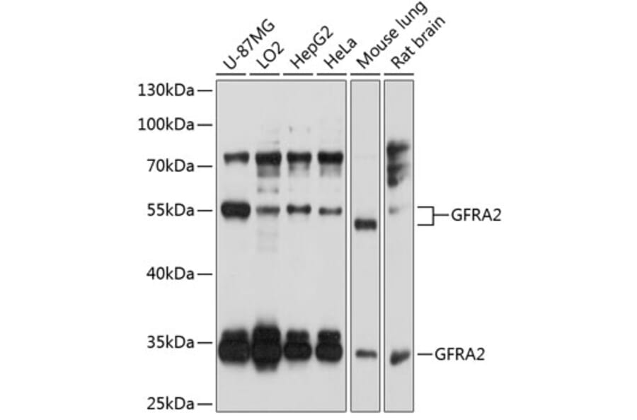 Western Blot - Anti-GDNF Receptor alpha 2/GFRA2 Antibody (A14272) - Antibodies.com