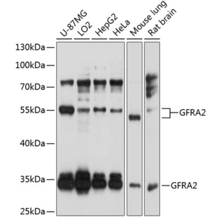 Western Blot - Anti-GDNF Receptor alpha 2/GFRA2 Antibody (A14272) - Antibodies.com