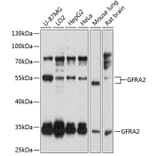 Western Blot - Anti-GDNF Receptor alpha 2/GFRA2 Antibody (A14272) - Antibodies.com