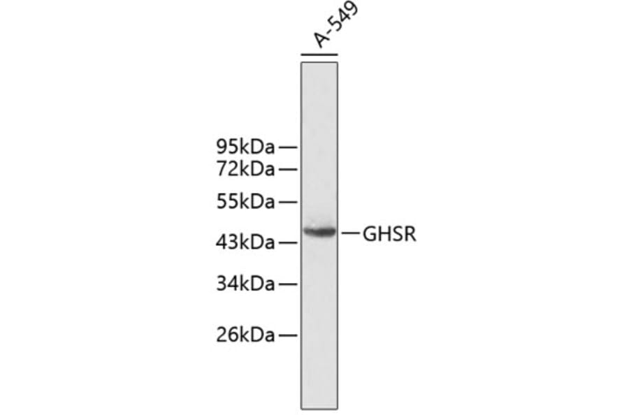 Western Blot - Anti-GHSR Antibody (A2957) - Antibodies.com