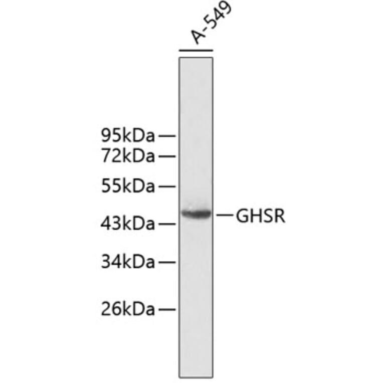Western Blot - Anti-GHSR Antibody (A2957) - Antibodies.com
