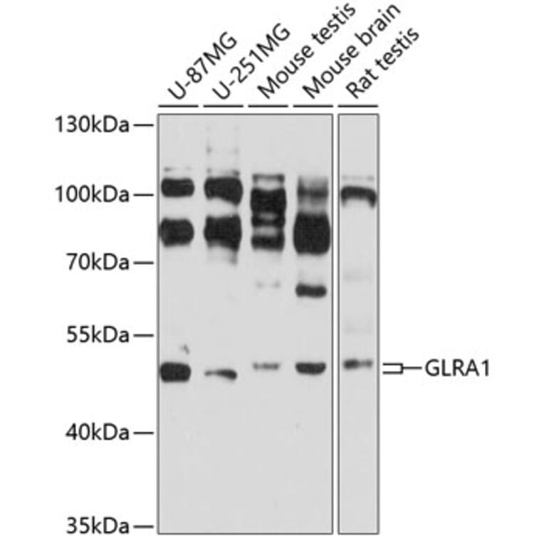 Western Blot - Anti-alpha 1 Glycine Receptor / GLRA1 Antibody (A14274) - Antibodies.com