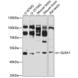 Western Blot - Anti-alpha 1 Glycine Receptor / GLRA1 Antibody (A14274) - Antibodies.com