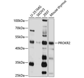 Western Blot - Anti-PROKR2 Antibody (A14275) - Antibodies.com