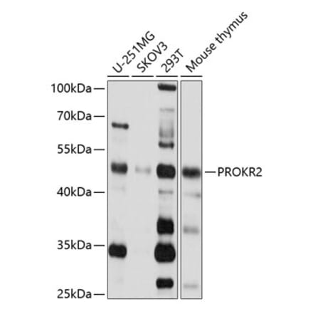 Western Blot - Anti-PROKR2 Antibody (A14275) - Antibodies.com