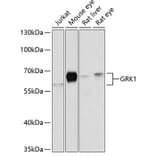 Western Blot - Anti-GRK1 Antibody (A2966) - Antibodies.com