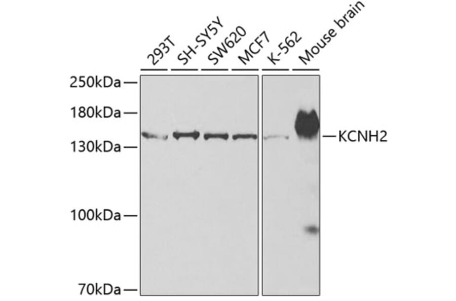 Western Blot - Anti-H-ERG Antibody (A14281) - Antibodies.com
