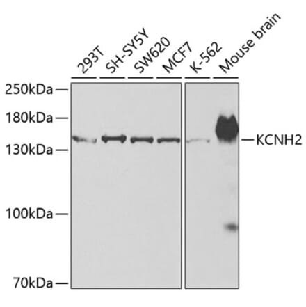 Western Blot - Anti-H-ERG Antibody (A14281) - Antibodies.com