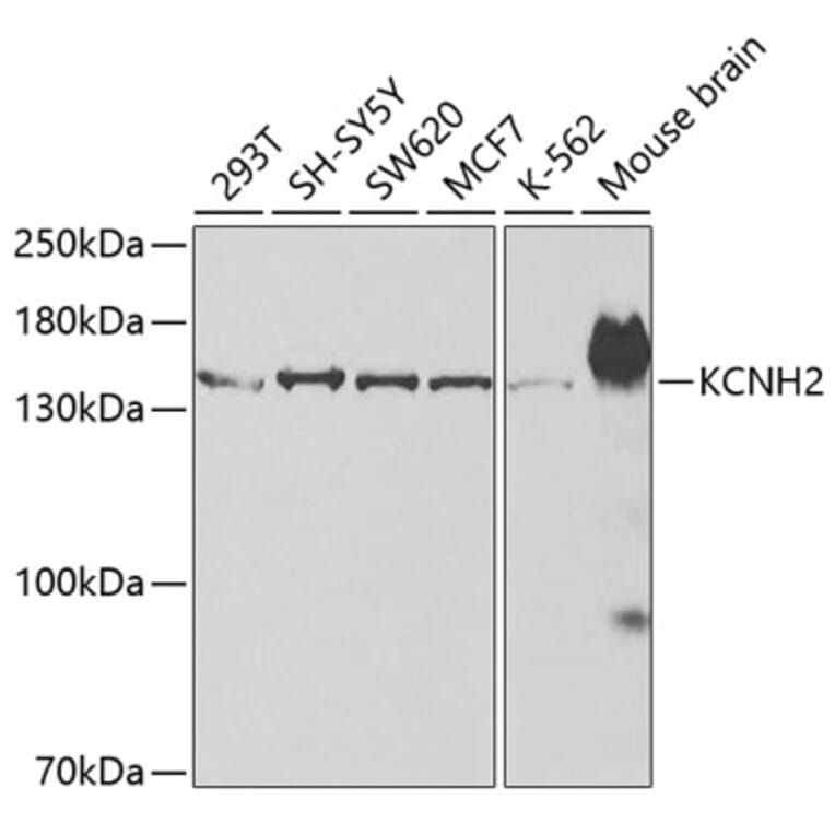 Western Blot - Anti-H-ERG Antibody (A14281) - Antibodies.com