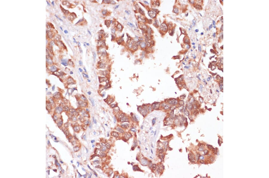 Immunohistochemistry - Anti-H-ERG Antibody (A14281) - Antibodies.com