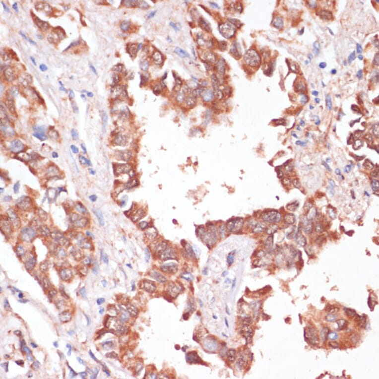 Immunohistochemistry - Anti-H-ERG Antibody (A14281) - Antibodies.com