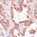 Immunohistochemistry - Anti-H-ERG Antibody (A14281) - Antibodies.com