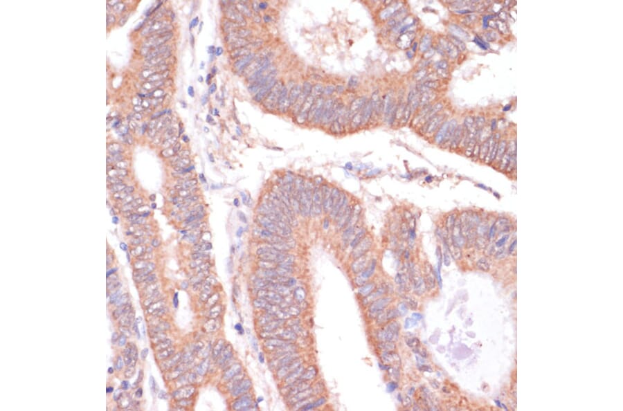 Immunohistochemistry - Anti-H-ERG Antibody (A14281) - Antibodies.com
