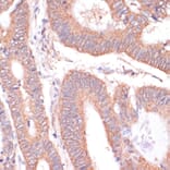 Immunohistochemistry - Anti-H-ERG Antibody (A14281) - Antibodies.com