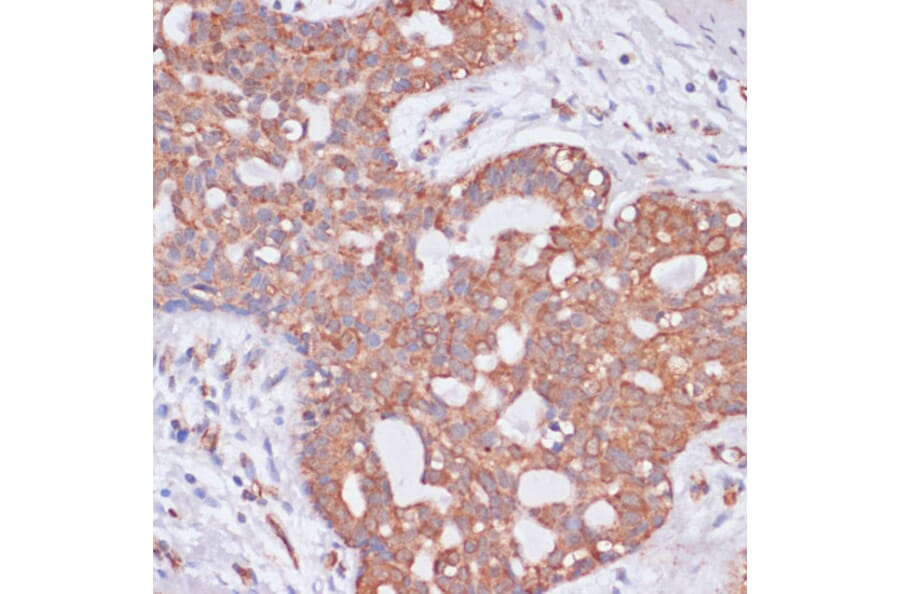 Immunohistochemistry - Anti-H-ERG Antibody (A14281) - Antibodies.com