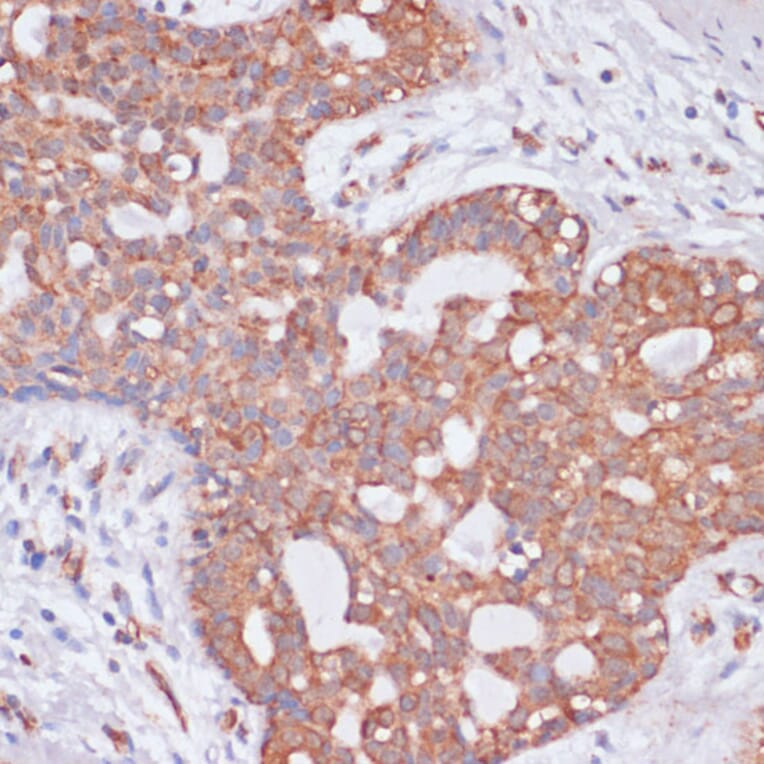 Immunohistochemistry - Anti-H-ERG Antibody (A14281) - Antibodies.com