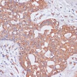 Immunohistochemistry - Anti-H-ERG Antibody (A14281) - Antibodies.com