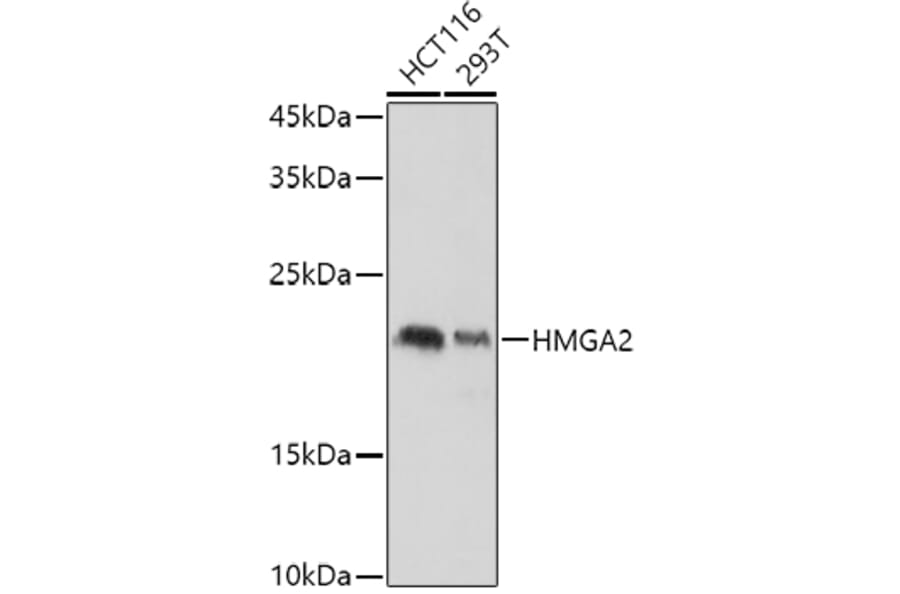 Western Blot - Anti-HMGA2 Antibody (A14284) - Antibodies.com