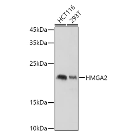 Western Blot - Anti-HMGA2 Antibody (A14284) - Antibodies.com