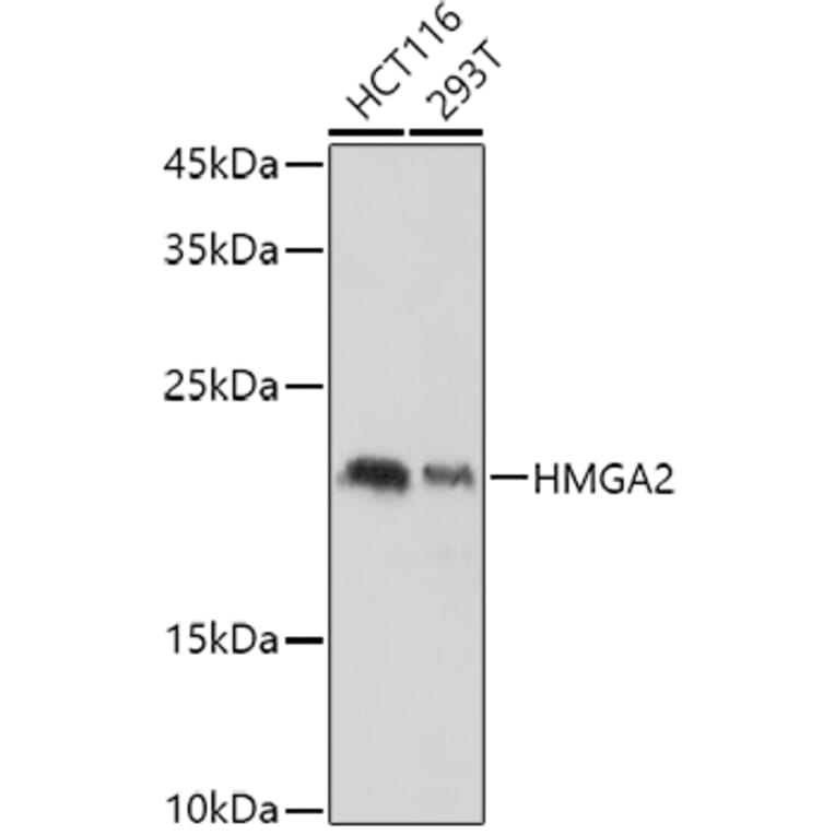 Western Blot - Anti-HMGA2 Antibody (A14284) - Antibodies.com