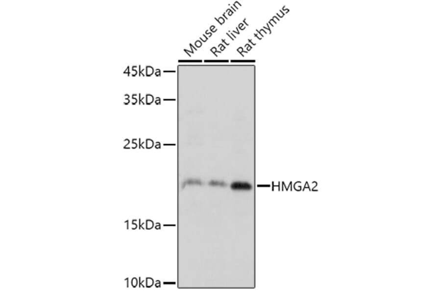 Western Blot - Anti-HMGA2 Antibody (A14284) - Antibodies.com