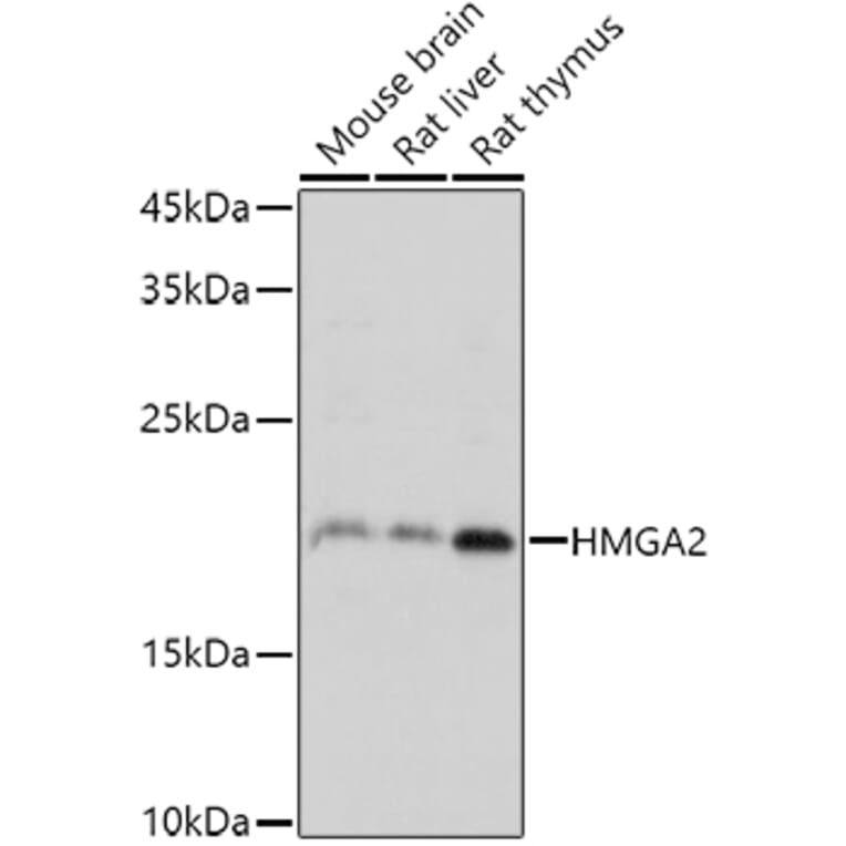 Western Blot - Anti-HMGA2 Antibody (A14284) - Antibodies.com