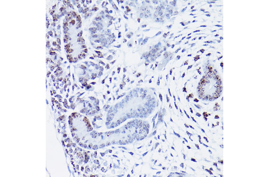 Immunohistochemistry - Anti-HMGA2 Antibody (A14284) - Antibodies.com