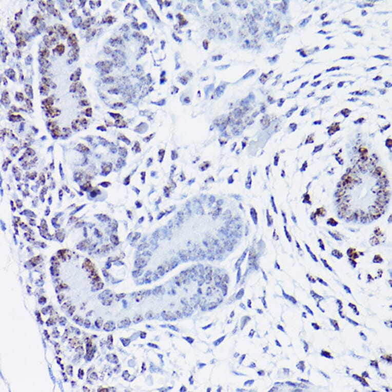 Immunohistochemistry - Anti-HMGA2 Antibody (A14284) - Antibodies.com