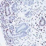 Immunohistochemistry - Anti-HMGA2 Antibody (A14284) - Antibodies.com