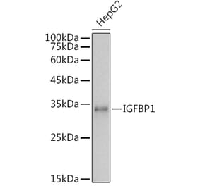 Western Blot - Anti-IGFBP1 Antibody (A14288) - Antibodies.com