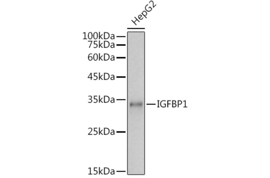 Western Blot - Anti-IGFBP1 Antibody (A14288) - Antibodies.com